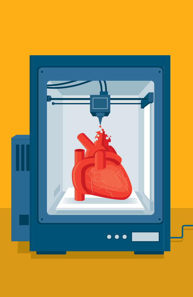 medical device